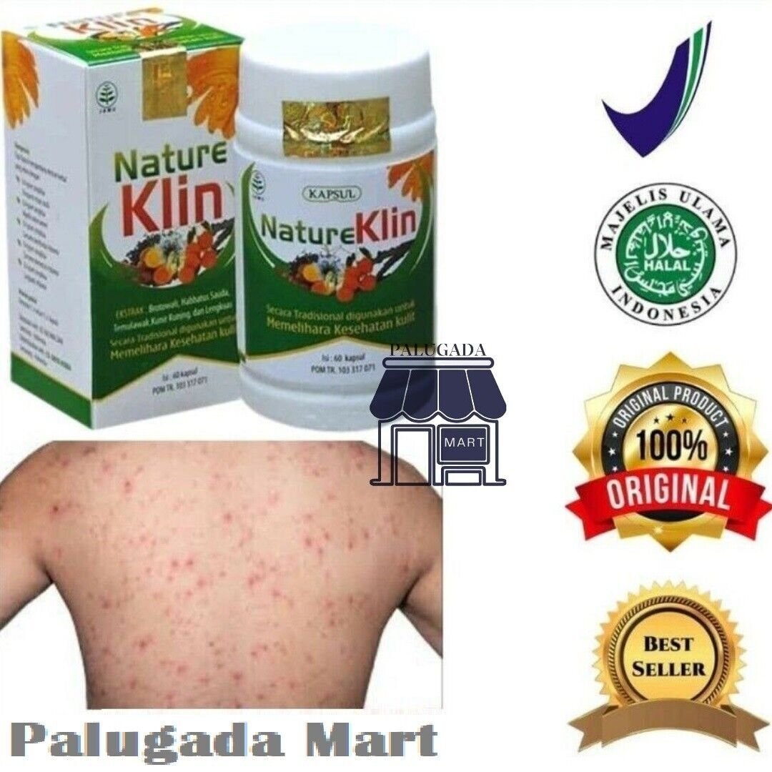 Original (60 Capsules) Nature Klin Herbal Medicine Ringworm Itching Fungal Eczema Skin Health